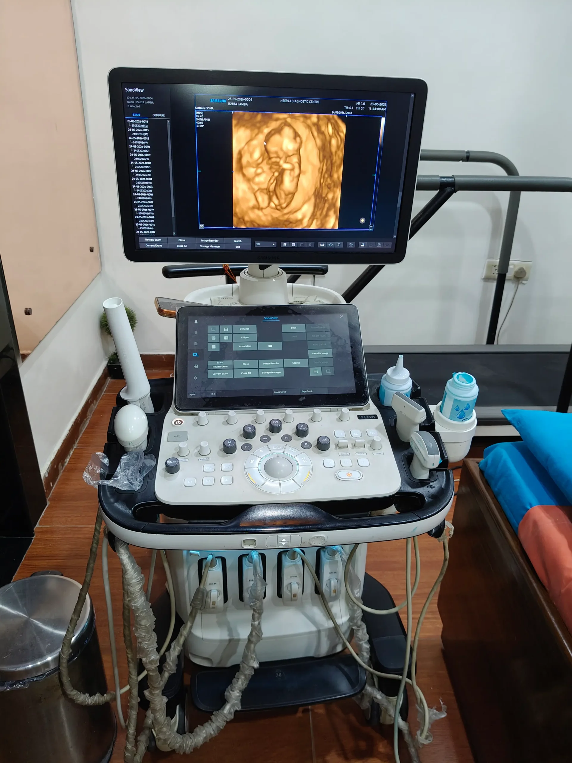 Ultrasound Machine